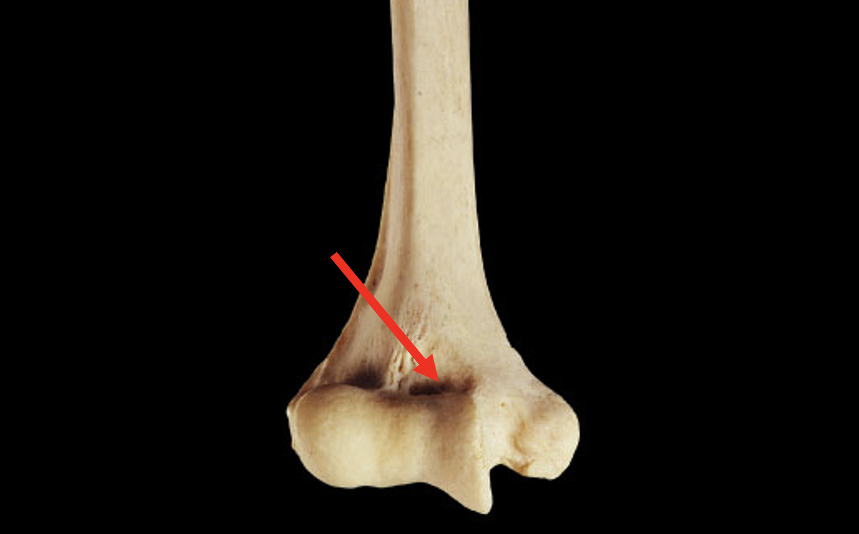 <p>Name this region of the humerus</p>