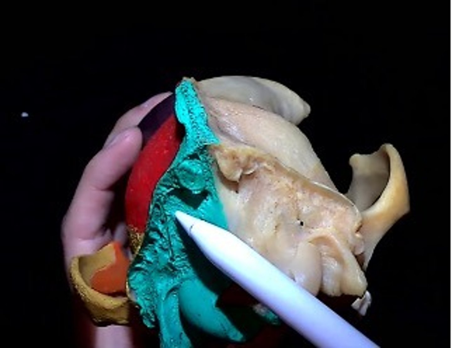 <p>Most posterior part of the skull base</p>