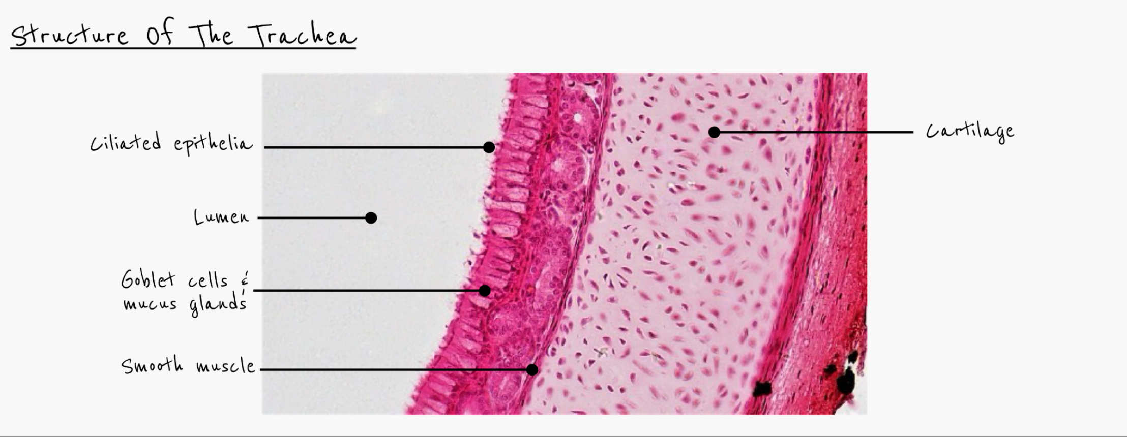 <p>Trachea </p>