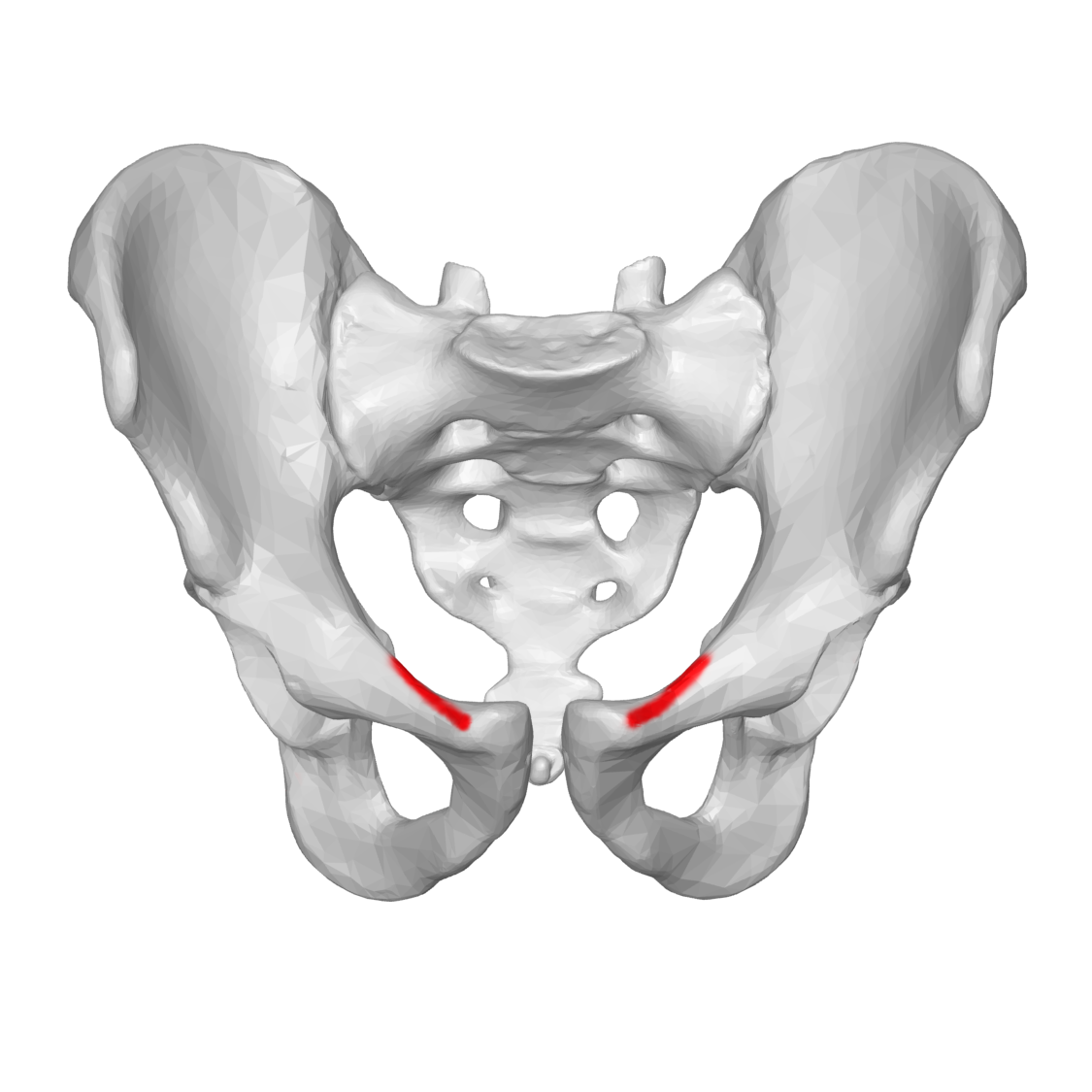 <p>A ridge located on the superior ramus of the pubis, serving as an attachment site for muscles and as a landmark for the pelvic inlet. </p>