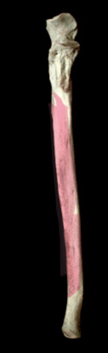 <p>What structure is this?</p>