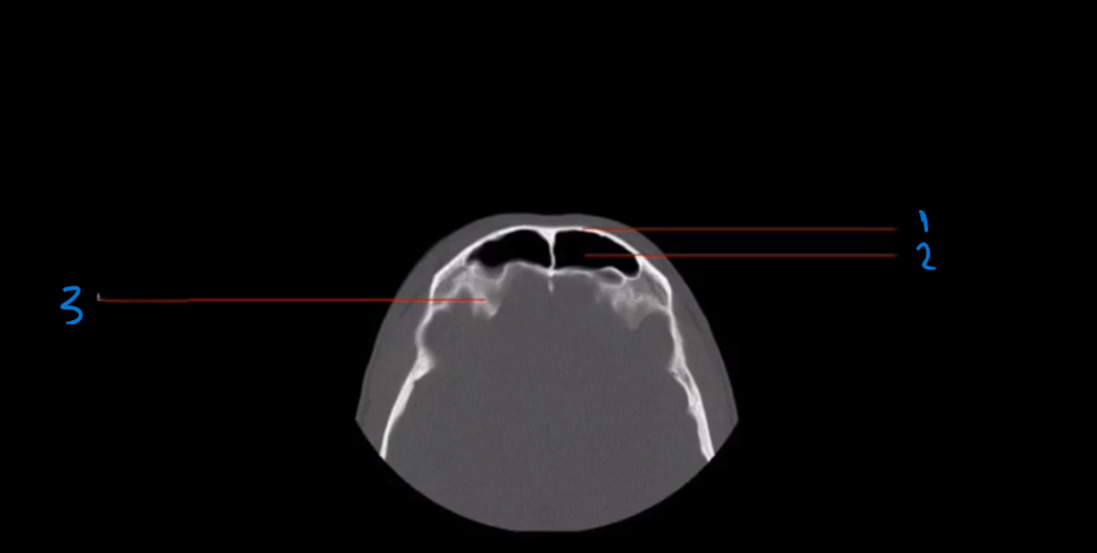 <p>What is landmark # 3 called?</p>