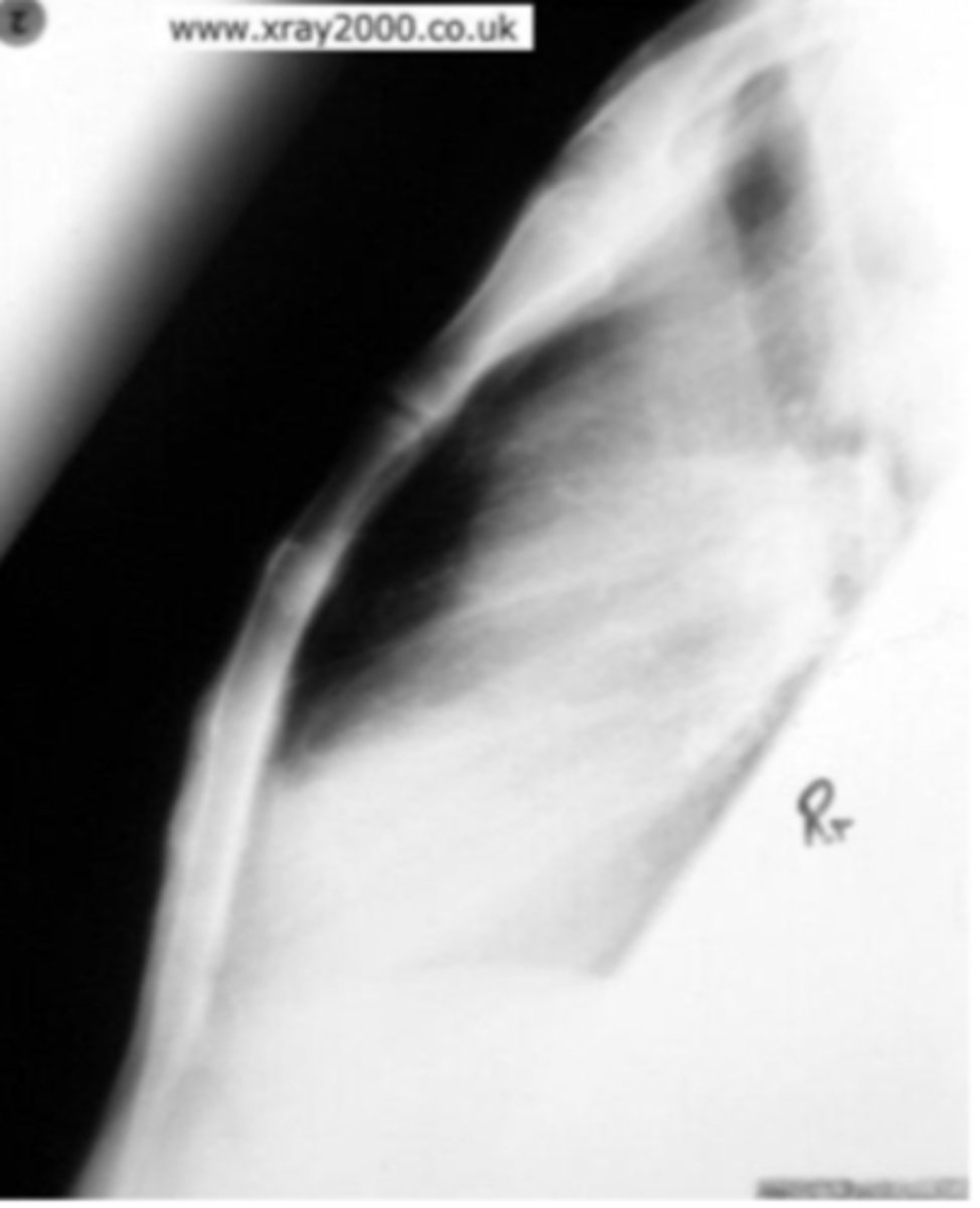 <p>What view is this?</p>