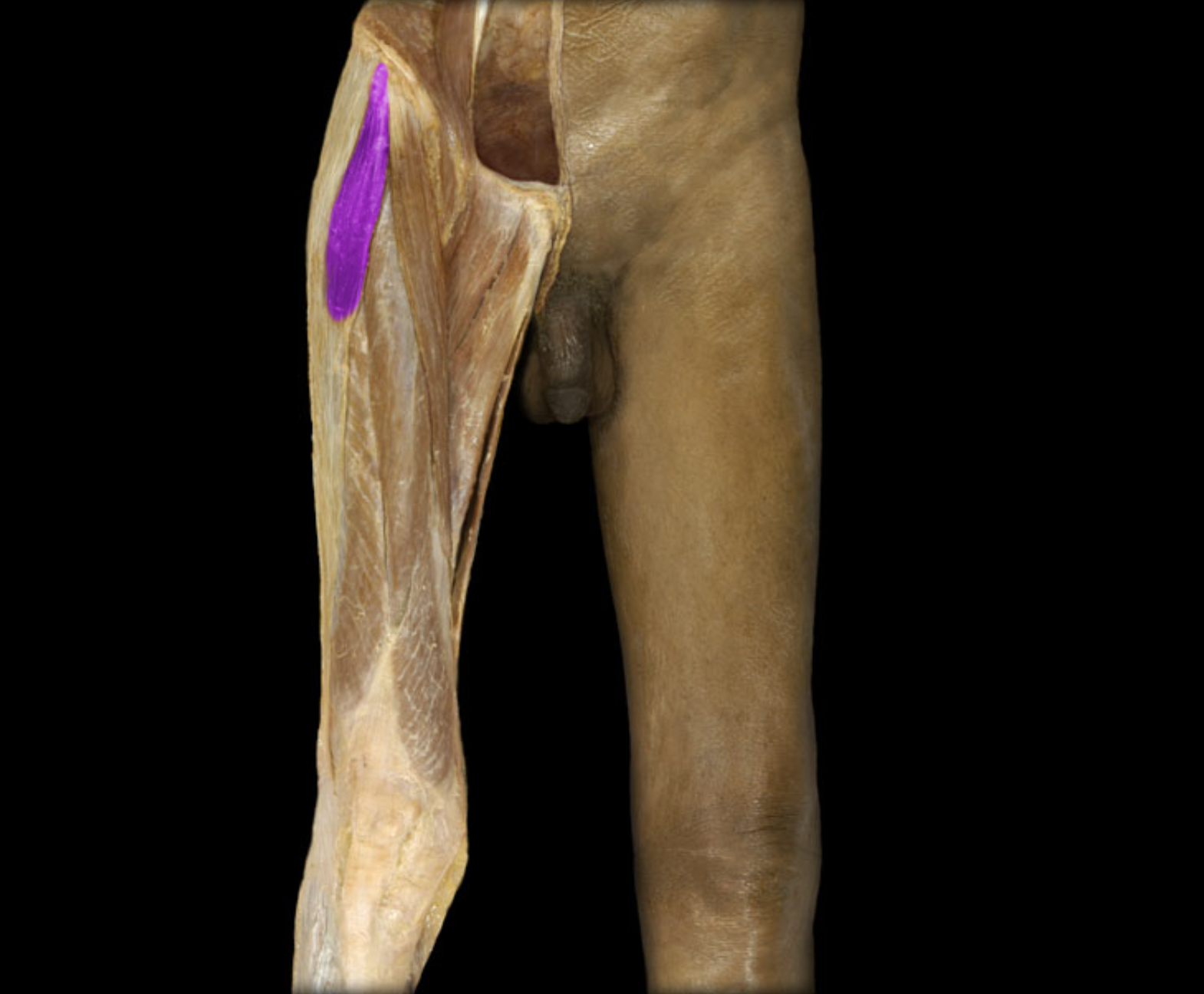 <p><span>P: Iliac Crest of hip b. and lateral surface of anterior superior iliac spine</span></p><p>D : Iliotibial band</p><p>Abducts the thigh at the coxal j.</p><p>Medially rotates thigh at coxal j.</p>