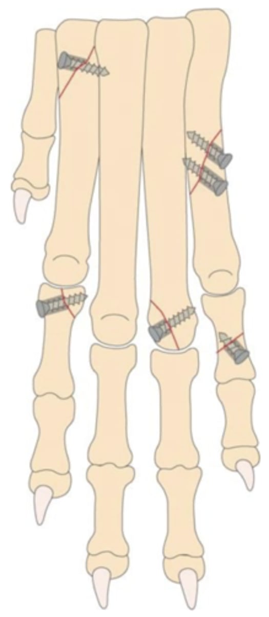 <p>What is happening here and how do you surgically treat it?</p>