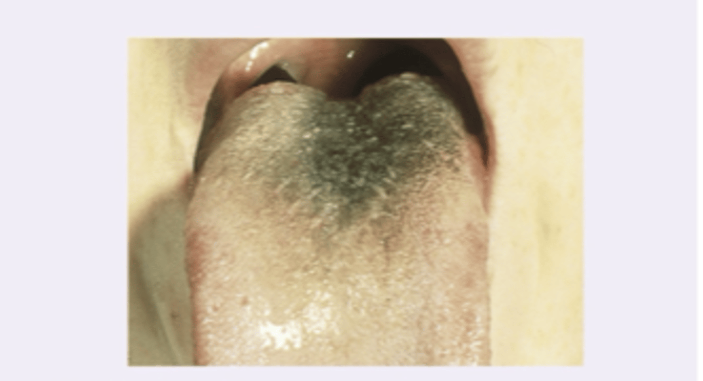<p>Diagnosis?</p>