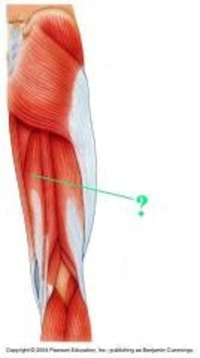 <p>Identify the indicated muscle.</p>