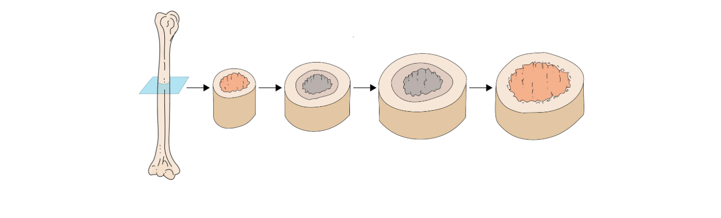 <p>Osteoblast activity in periosteum vs Osteoclast activity in Endosteum</p><p>Allow bone to grow in diameter and remain lightweight&nbsp;</p>