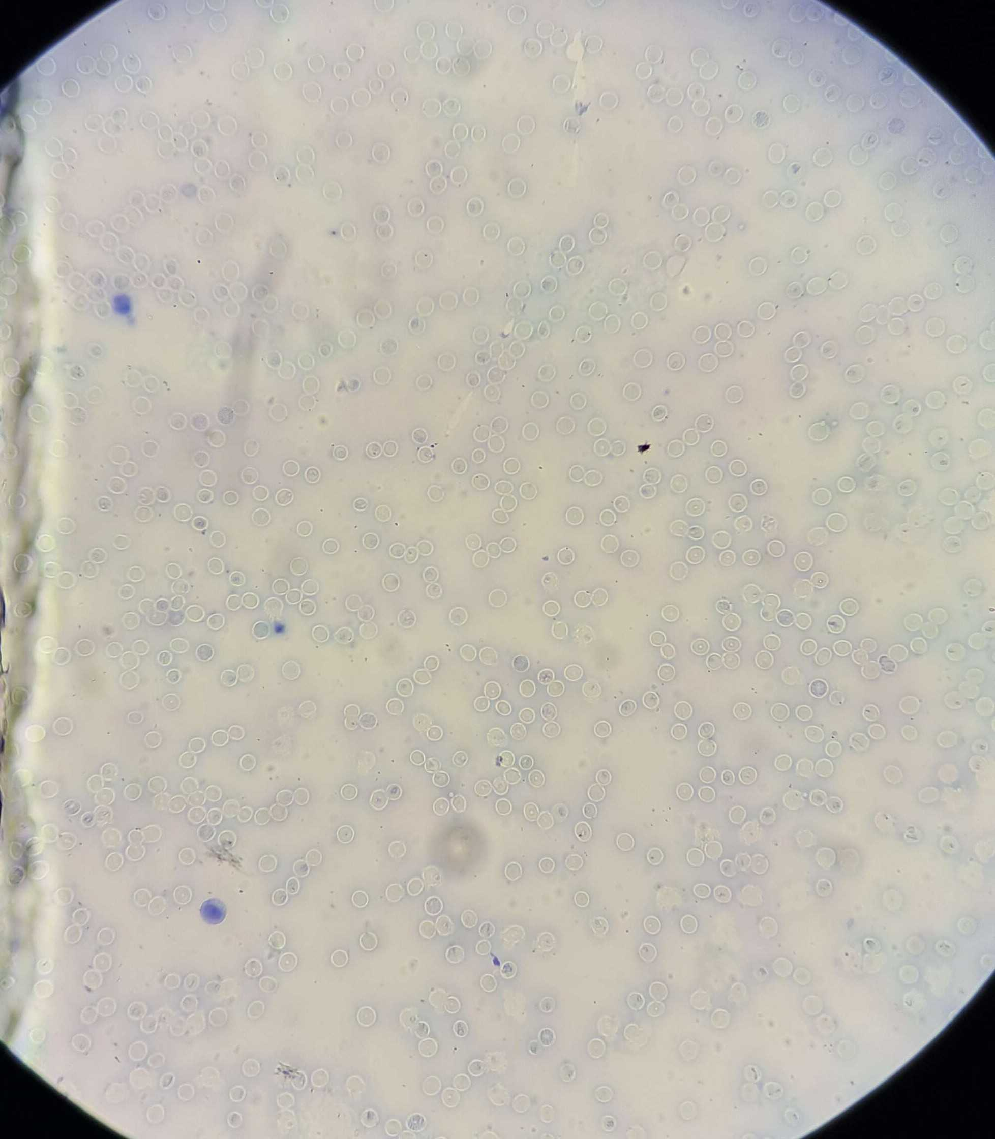 <p><span data-name="microscope" data-type="emoji">🔬</span><span data-name="petri_dish" data-type="emoji">🧫</span><strong><span> </span>Na podstawie zdjęcia preparatu:</strong></p><p></p><ul><li><p><span>📖 </span>rozpoznaj gatunek pasożyta;</p></li></ul><p></p><ul><li><p><span>♻ </span>rozpoznaj wszystkie formy rozwojowe;</p></li></ul><p></p><ul><li><p><span>🦠 </span>wskaż organelle i cechy charakterystyczne dla danego gatunku;</p></li></ul><p></p><ul><li><p><span>😷 </span>nazwij chorobę, którą pasożyt wywołuje.</p></li></ul><p></p>