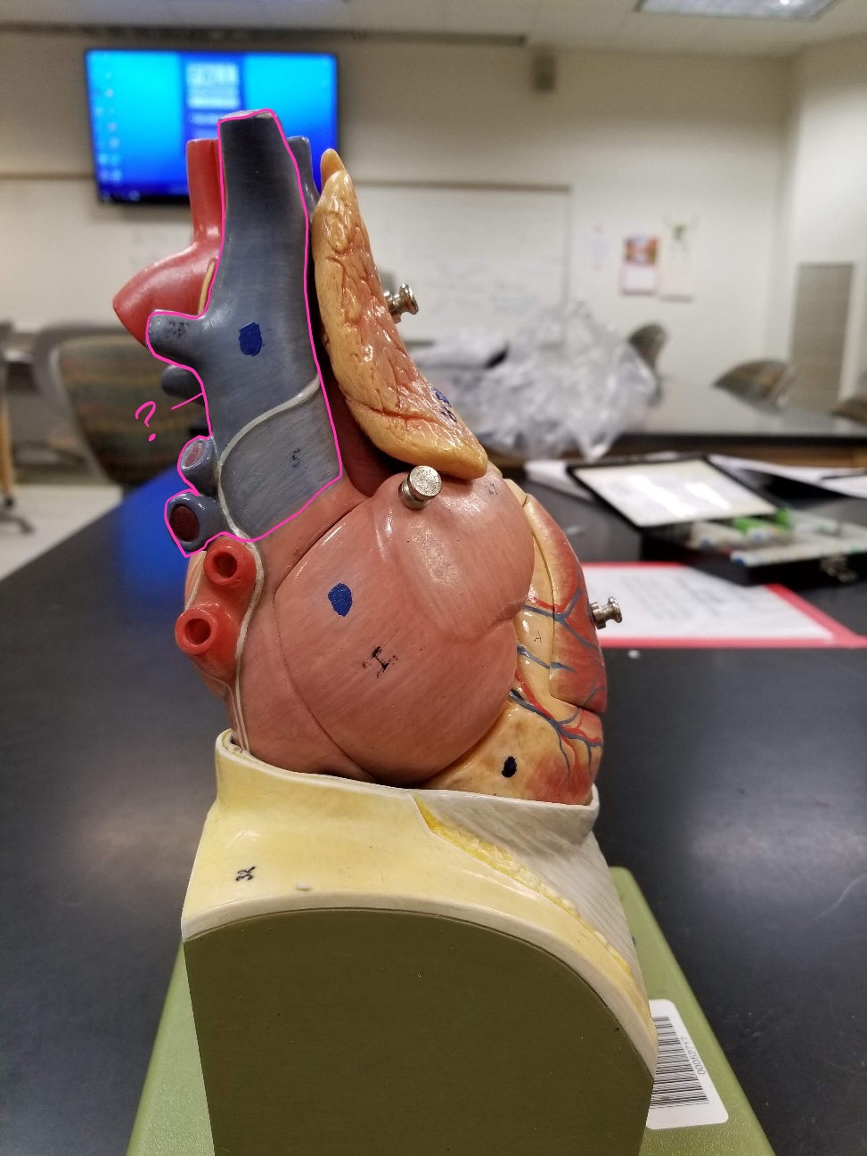 <p>what is outlined in pink? (transports blood from the upper portion of the body to the heart)</p>