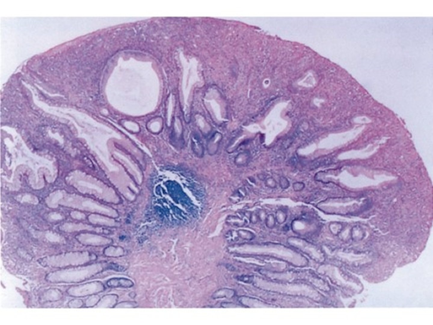 <p>Tissue is a collection of similar cells that help perform a function. A group of tissues is called an organ</p>