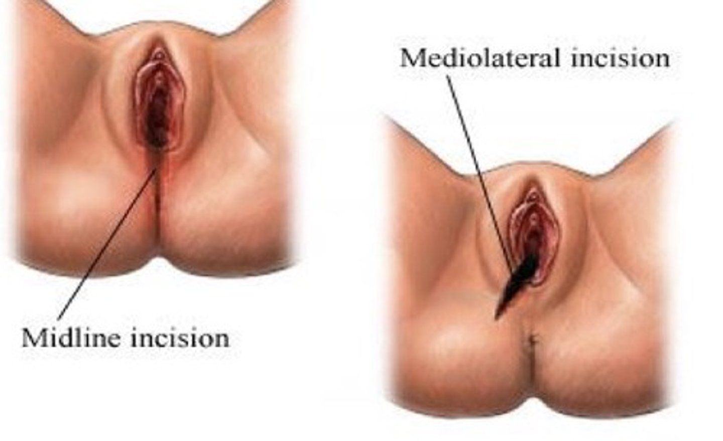 <p>bulbospongiosus and transverse perineal muscles</p>