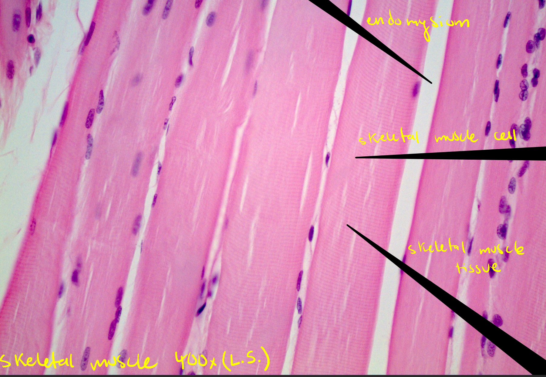 <p>Skeletal muscle tissue</p>