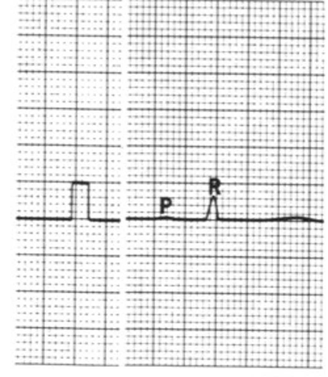 <p>What is the sensitivity of this if I tell you 1/2 cm = 1 mV</p>