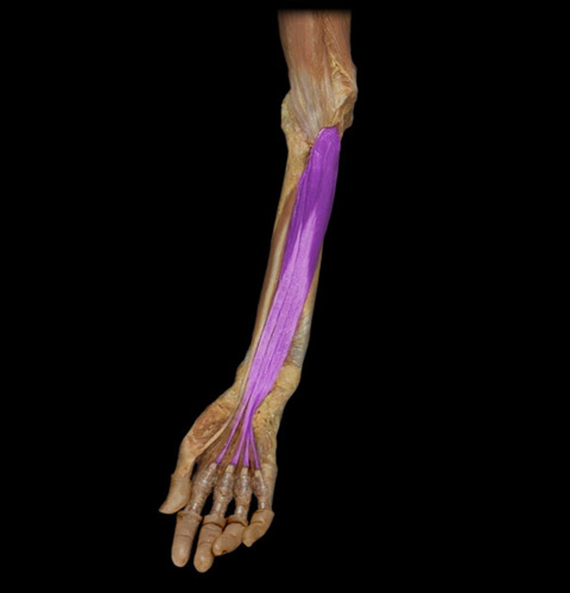 <p>Origin: Anteromedial surface of ulna; interosseous membrane</p><p>Insertion: Distal phalanges of fingers 2-5</p><p>Action: Flexes hand at the wrist; flexes MP joints; flexes PIP joints; flexes DIP joints of fingers 2-5</p><p>Innervation: Lateral one-half of muscle innervated by median nerve (C6-C8 fibers), medial one-half of muscle innervated by ulnar nerve (C8 fibers)</p>