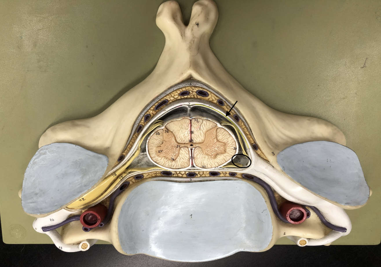 <p>what is this part of the vertebrae (of the spinal cord?)</p>