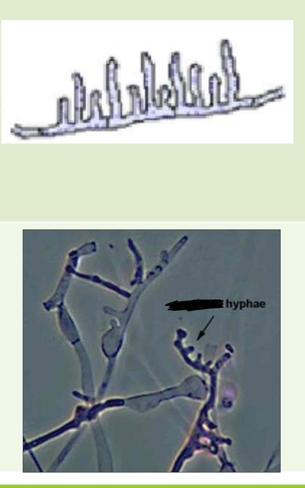 <p>Name this hyphae</p>