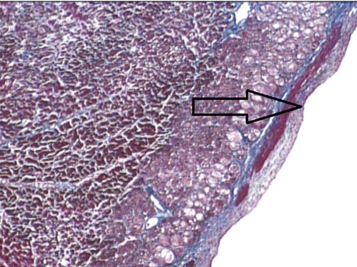 <p>Identify the layer at the arrow? Endothelium of the endocardium</p>
