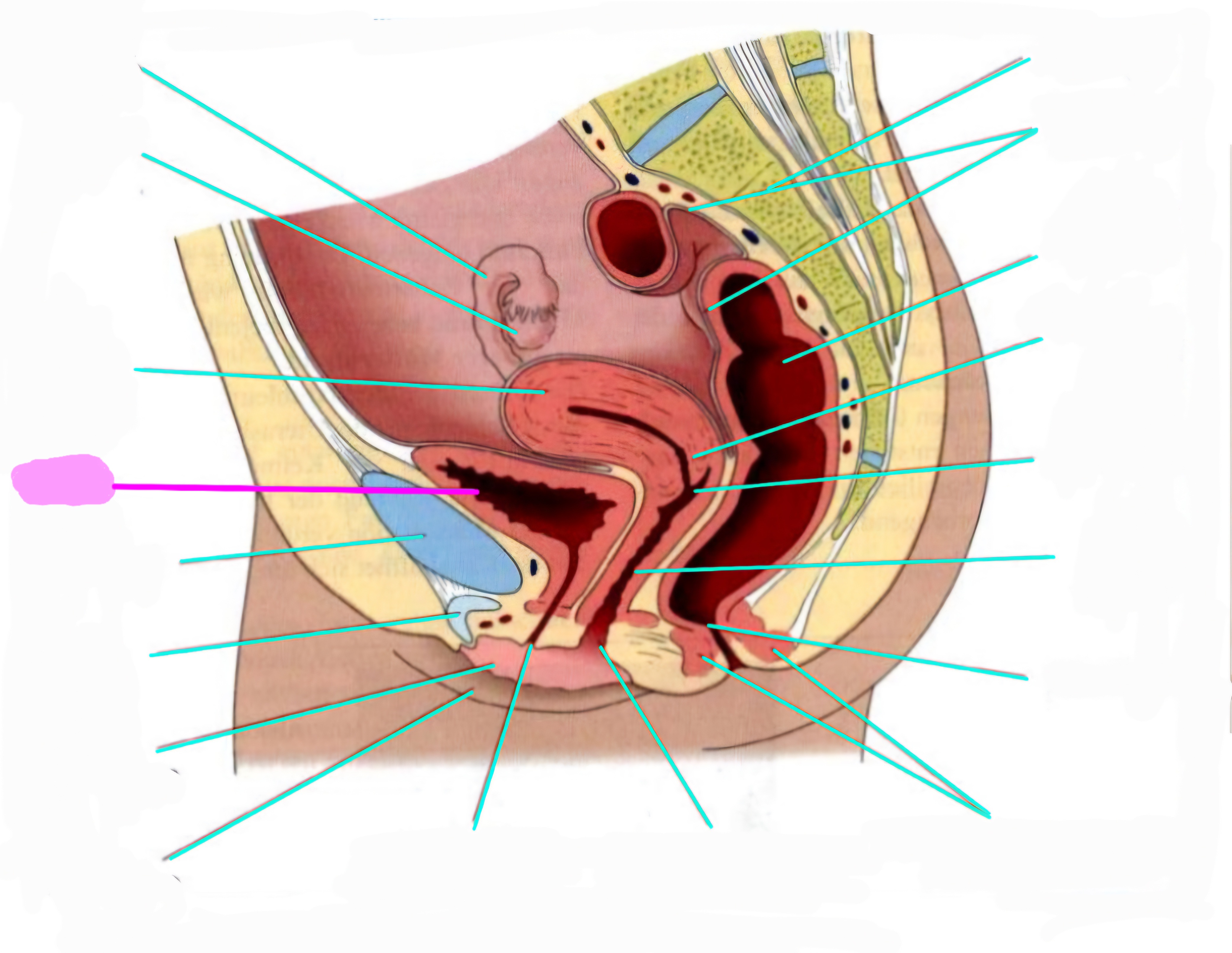 term image