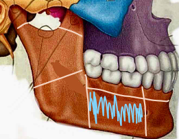 <p>What part of the mandible?</p>