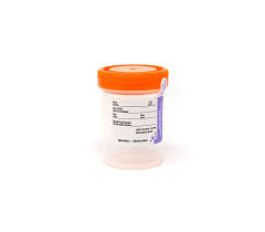 <p>Urine</p>