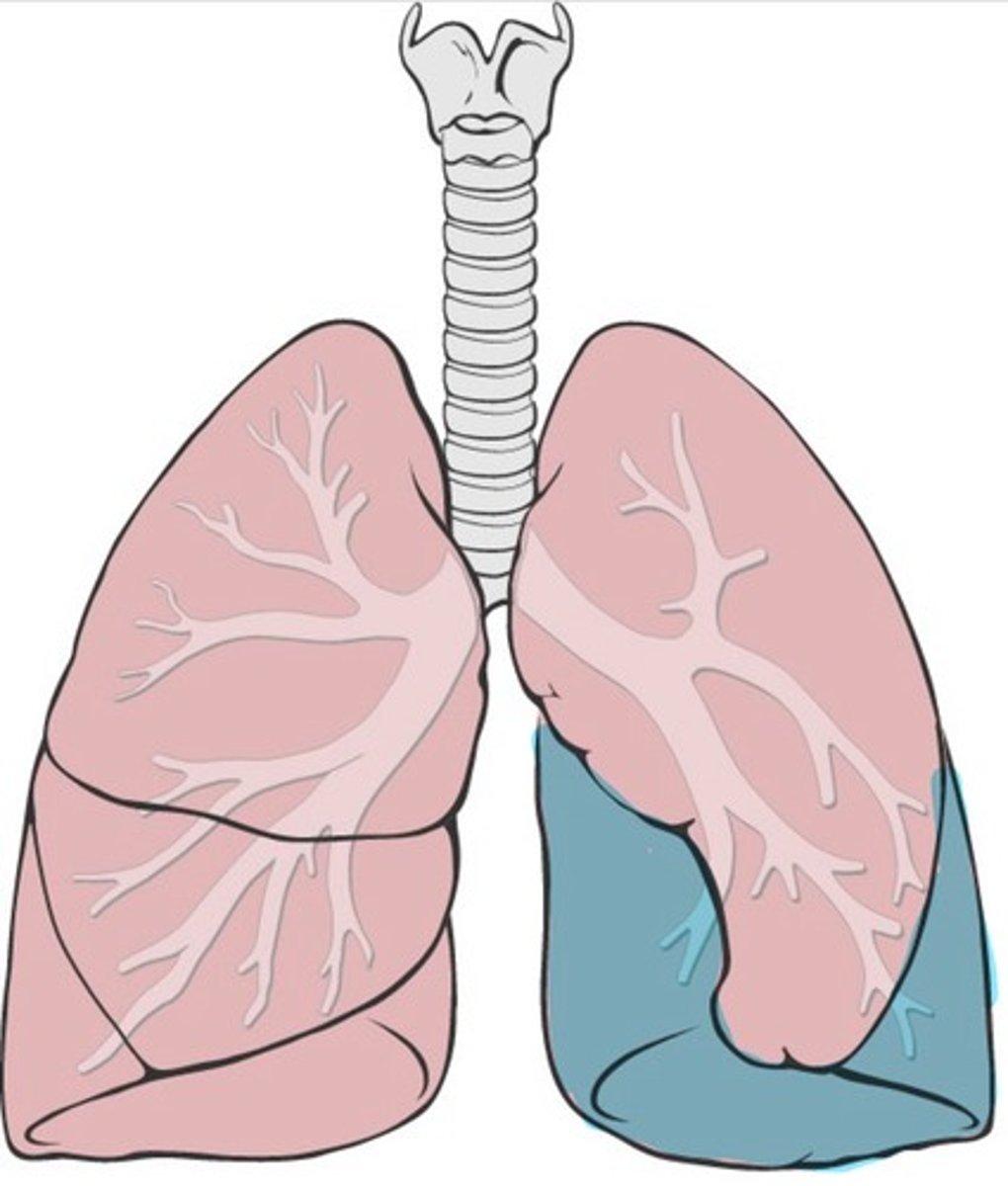 <p>Bottom lobe of left lung</p>