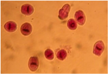 <p>Hydatid sand</p><p>Detached scolices, brood capsules, and daughter cysts that fall in hydatid fluid.</p><p>Fluid aspirated from surgically removed cyst.</p>
