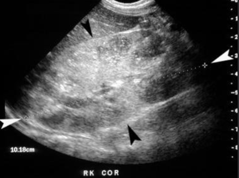 <ul><li><p>requires background info</p></li></ul><p></p>