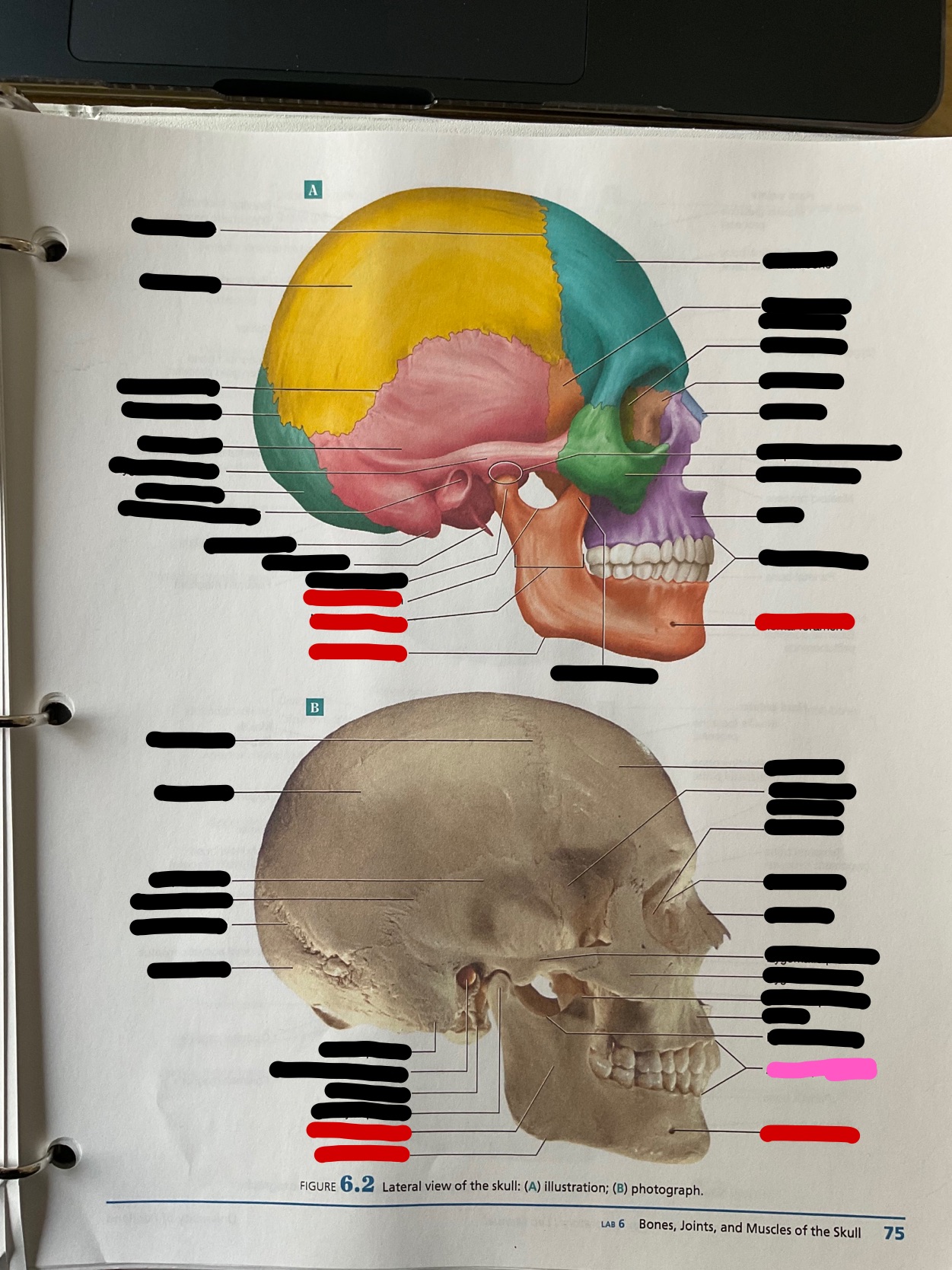 What bone feature is this?