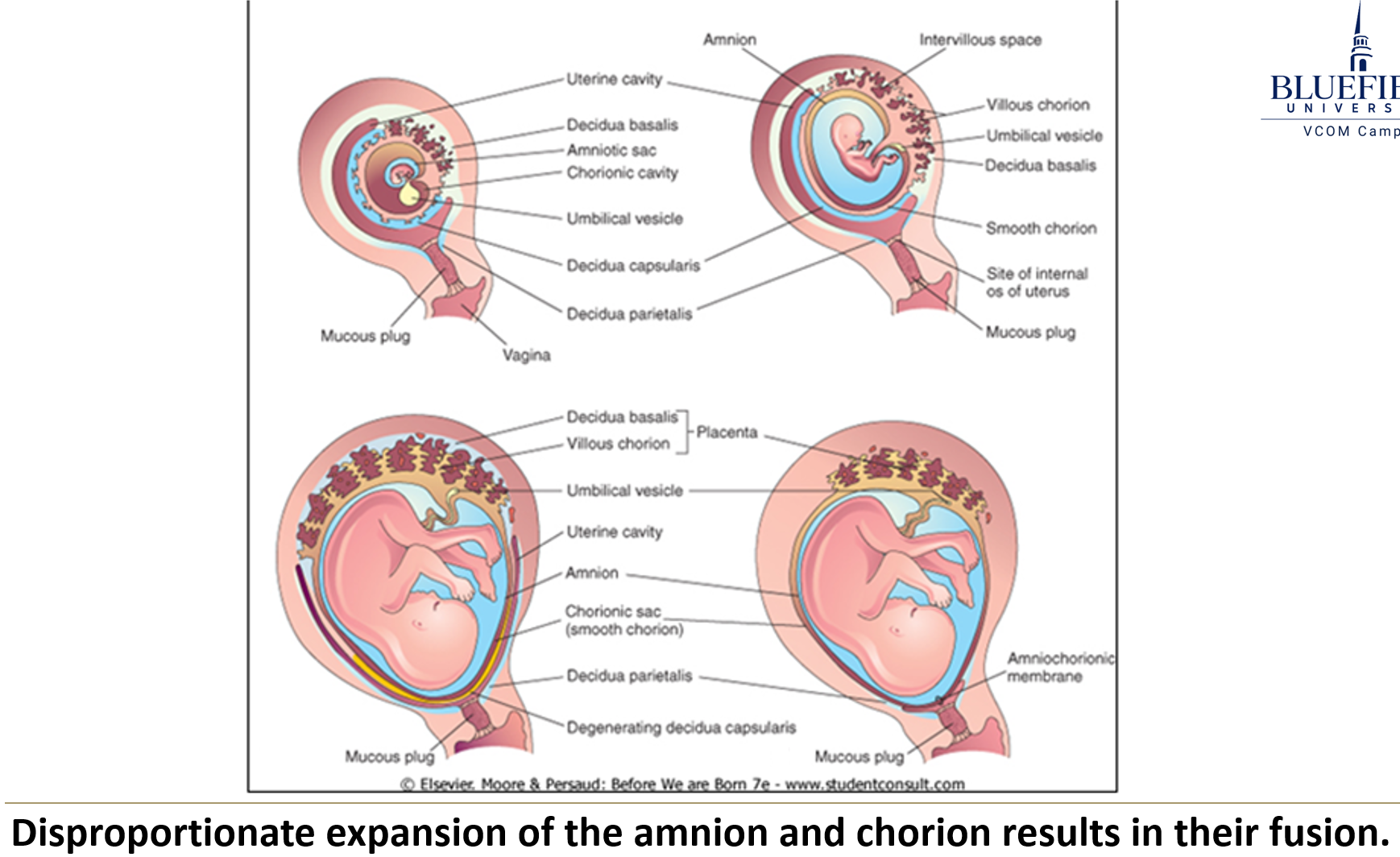 <p>What occurs during the rapid expansion of the<strong> amniotic cavity</strong> (weeks 10–20)?</p>