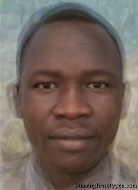 <p>Identify this Phenotype</p>