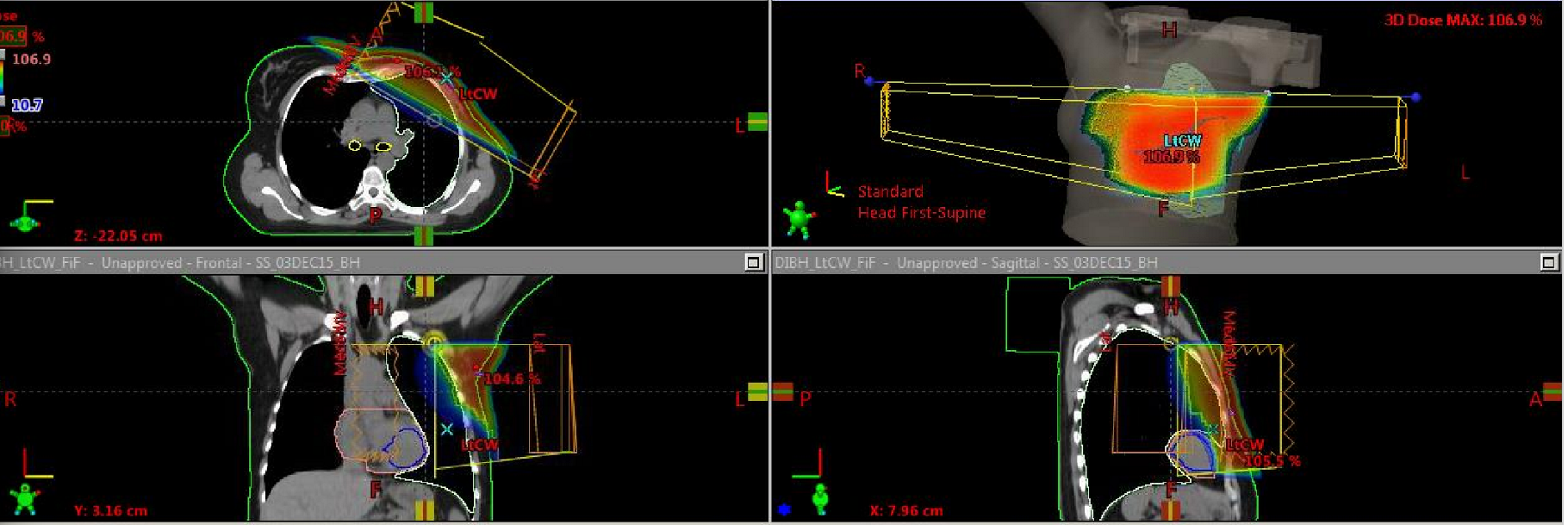 <p>What type of surgery has this patient had? Would we expect bolus?</p>