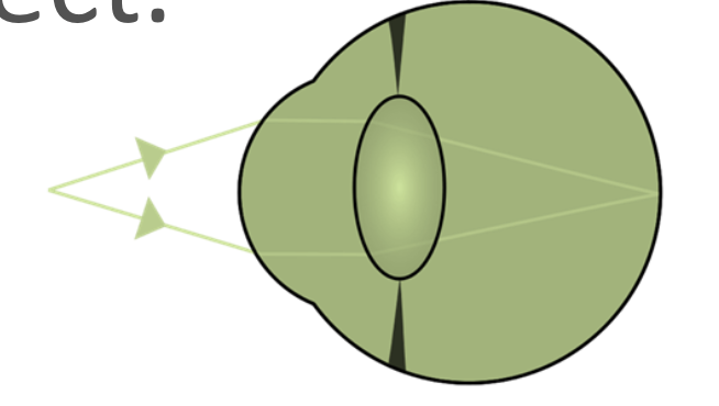 <ul><li><p><span>Ciliary muscles contract.</span></p></li><li><p><span>Suspensory ligaments slacken.</span></p></li><li><p><span>Lens becomes fatter.</span></p></li></ul><p>This is to refract light stronger.</p><p>Wide angel rays</p>