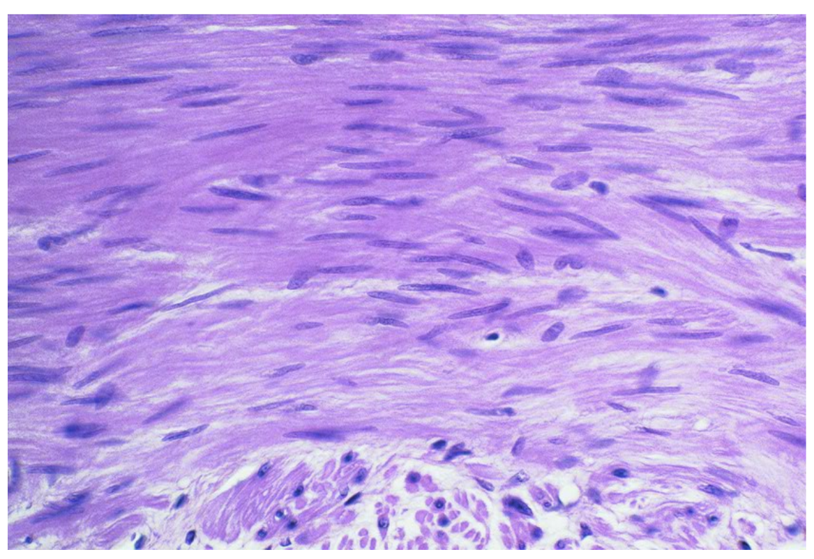 <p>Name the tissue.</p>