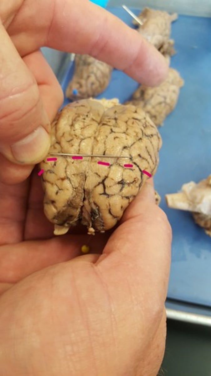 <p>separates frontal and parietal lobes</p>