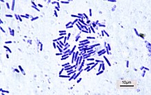 <p>What shape is this bacteria?</p>