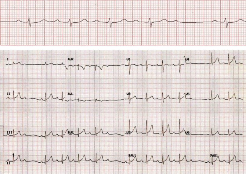 <p>What does this indicate</p>