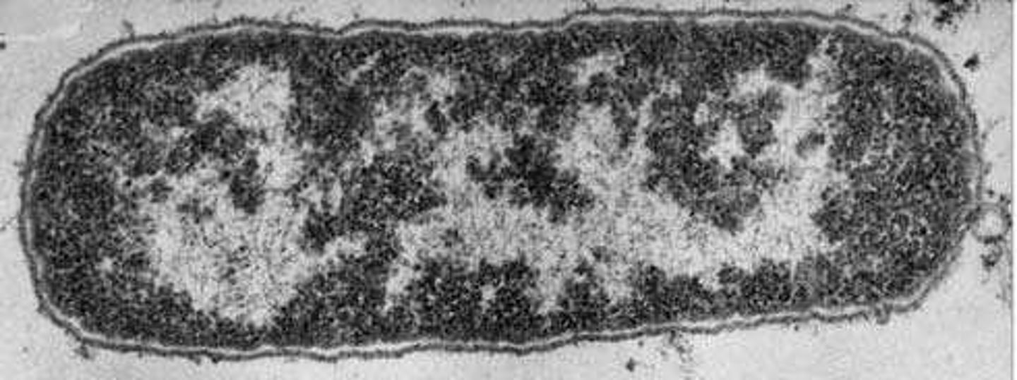 <p>Double-stranded molecule storing hereditary information.</p>