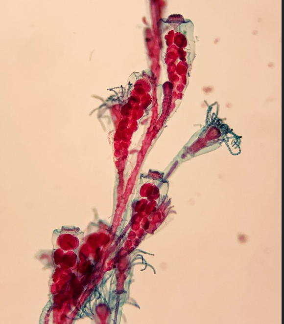 <p>Phylum?Class?<br>Symmetry? Tissue type? </p><p>What Lifecycle?</p>