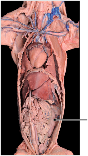 <p>Name the anatomical feature shown on the image of the ventral view of the viscera.</p>