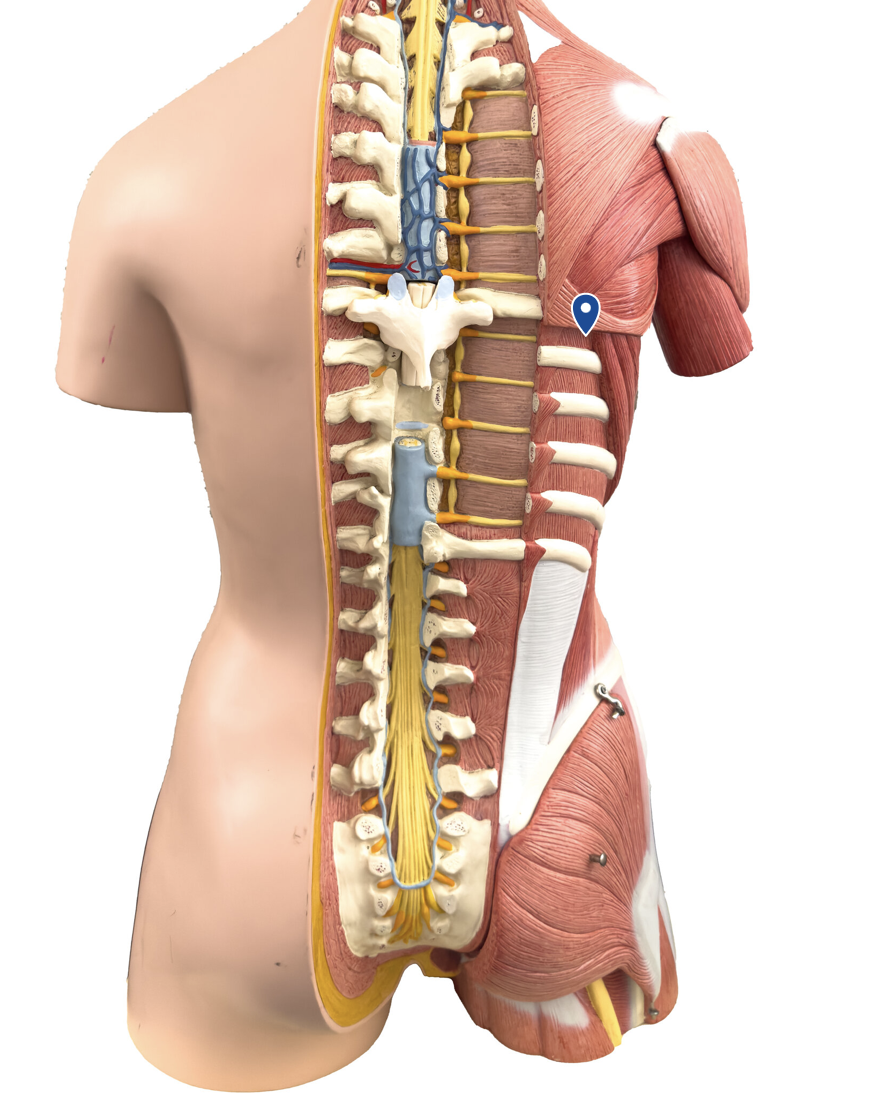 <p>What muscle is the arrow pointing to?</p>