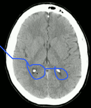 <p>Is this normal/abnormal?</p>