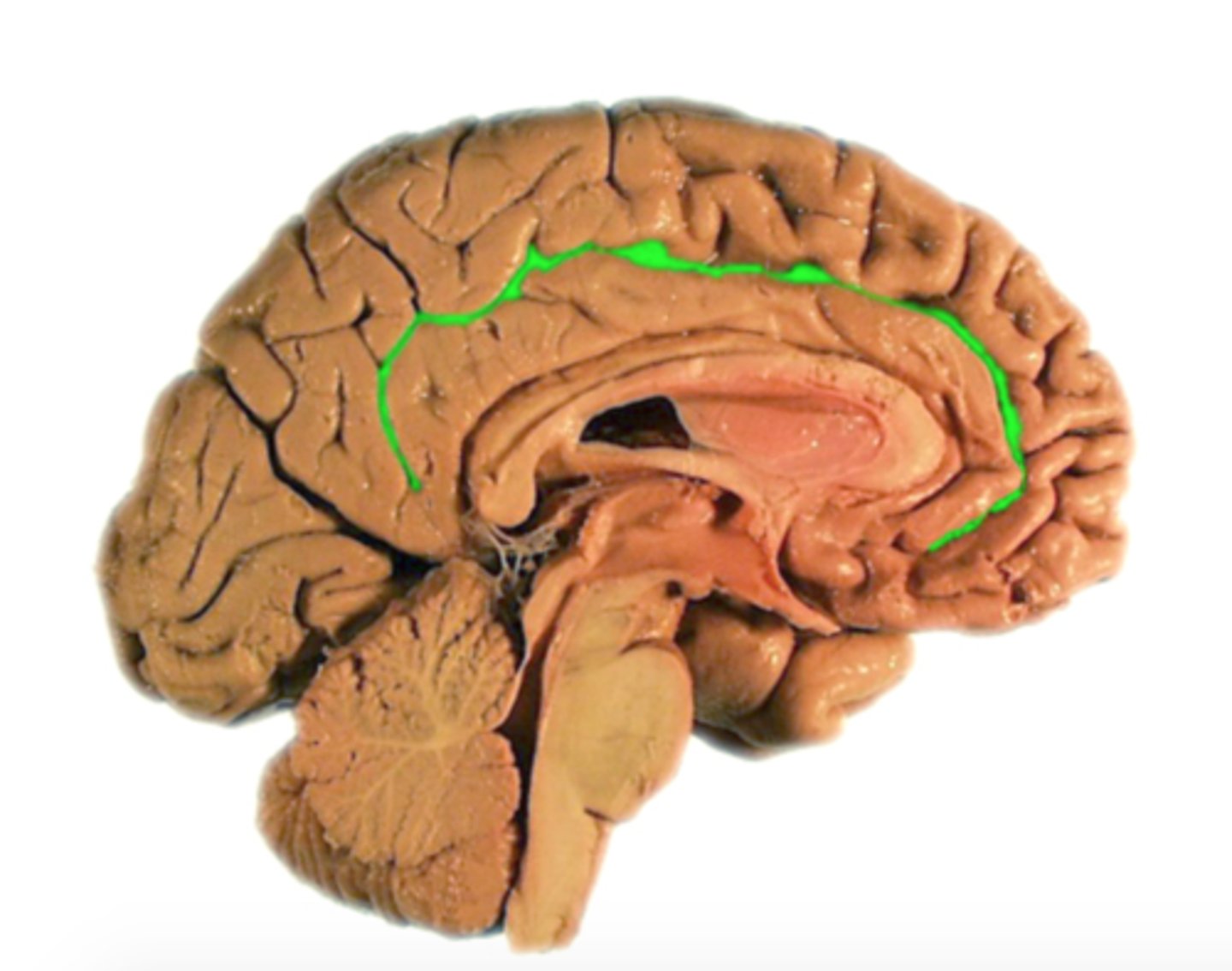 <p>Separates frontal and parietal lobes from cingulate gyrus</p>