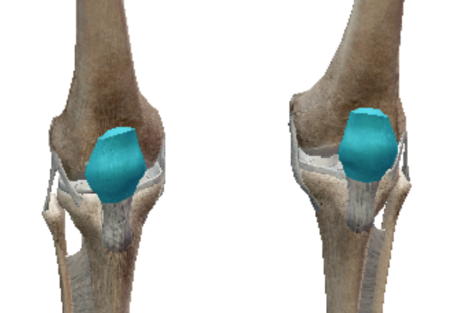 <p>Sesamoid bones</p>