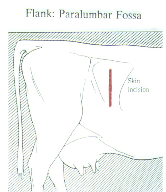 <p>6-8cm (~hand width) ventral to transverse processes and 4-6cm caudal to last rib. Dorsoventral direction for approx 25cm</p>