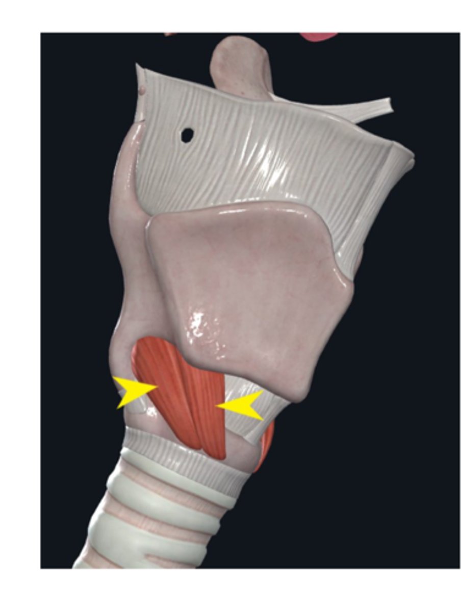 <p>What is this muscle?</p>