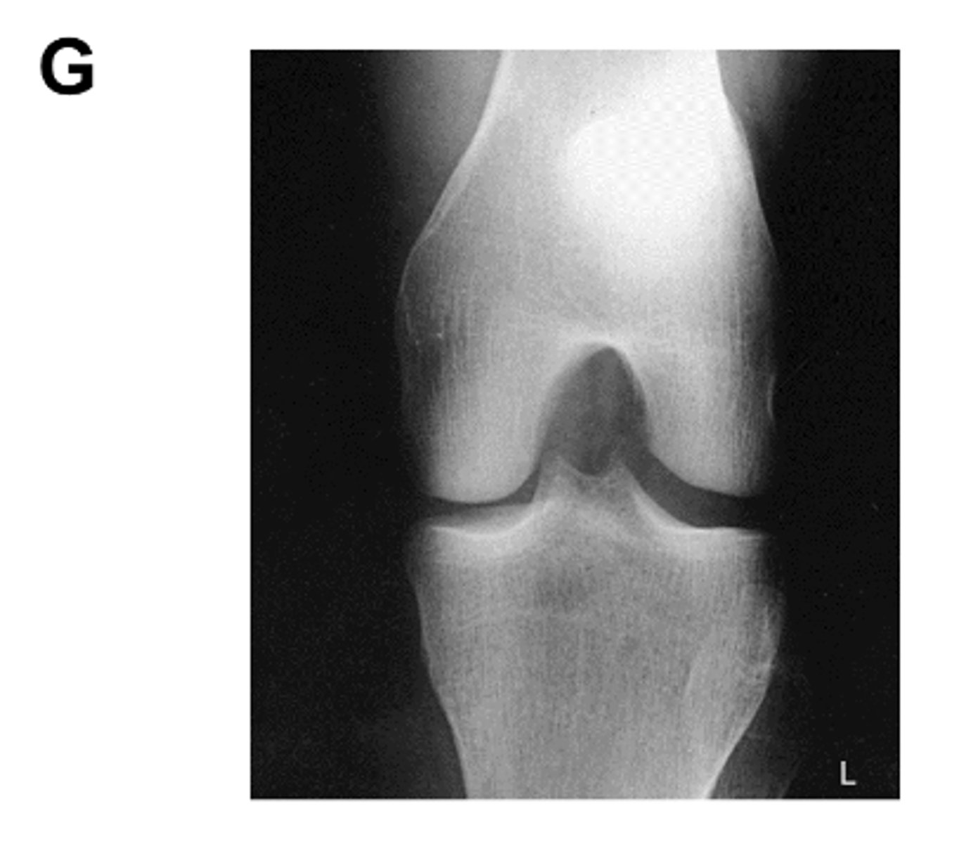 <p>Identify the projection:</p>