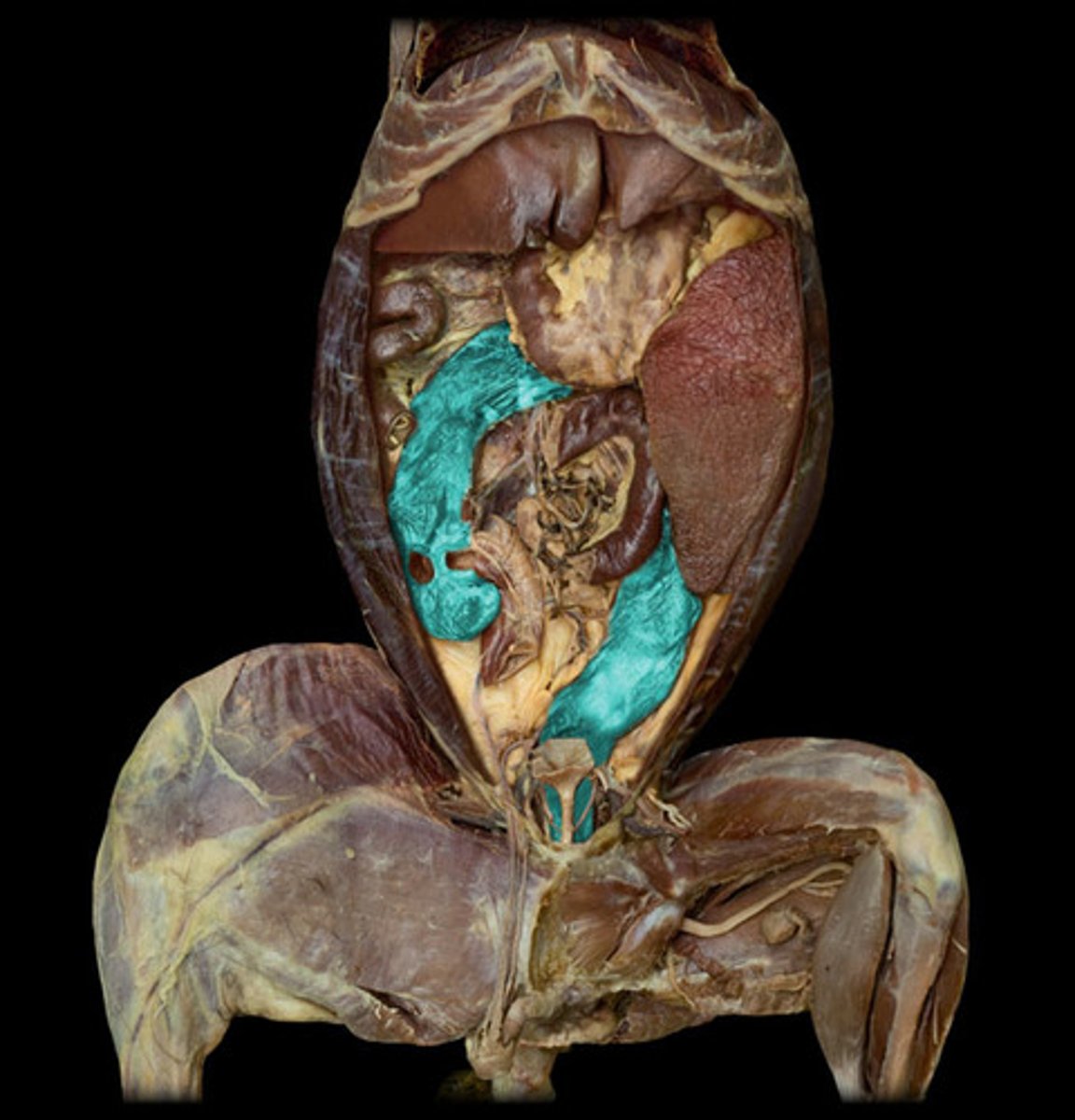 <p>left side of lower abdominal cavity</p>