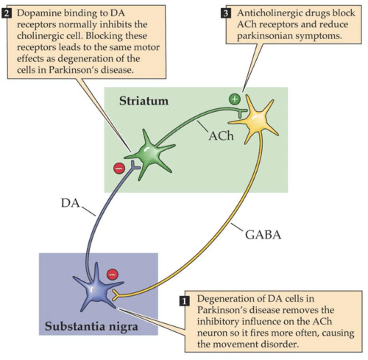 <p>-S.N. dies</p><p>-S.N. releases less DA</p><p>-More ACh is released</p><p>-Results in more inhibition SN via GABA</p><p>-Look at this more</p>