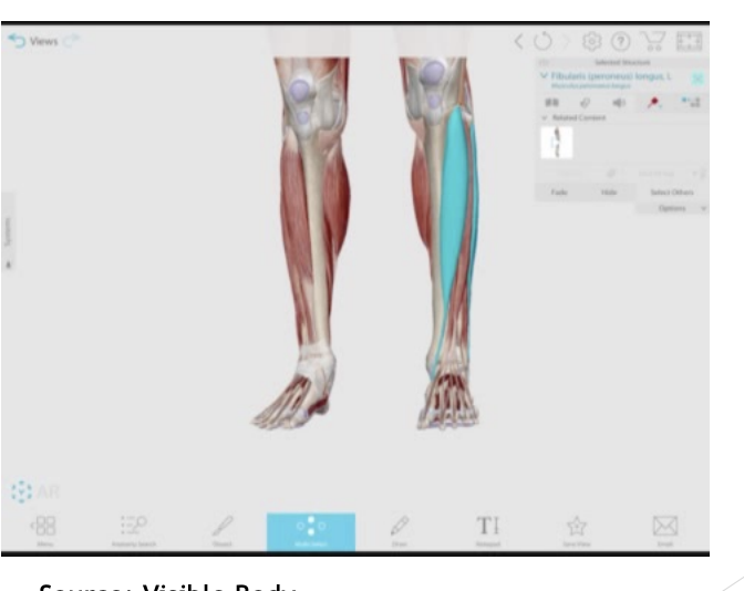 <p>“Suspension” support for arch of foot</p>